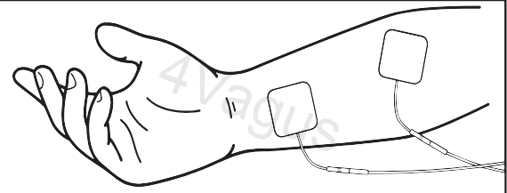 Umieszczanie elektrody na ramieniu