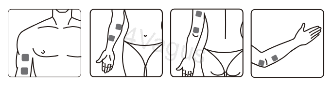 Rozmieszczenie elektrod EMS na ramieniu