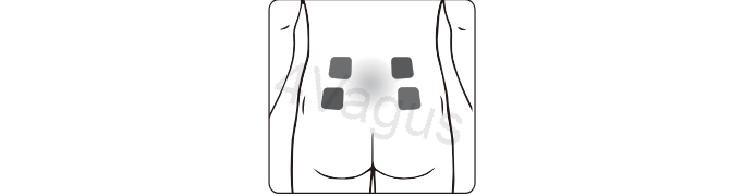 Rozmieszczenie elektrod EMS na plecach