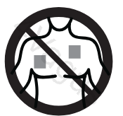 Zakaz stymulacji w okolicy serca