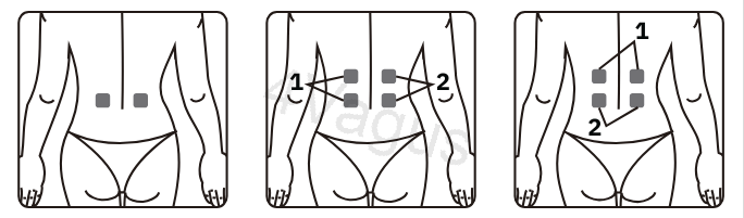 Rozmieszczenie elektrod TENS na plecach (wskazane pozycje 1 i 2)