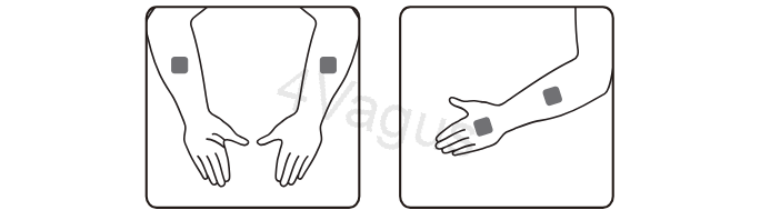 Rozmieszczenie elektrod TENS na stawie nadgarstkowym